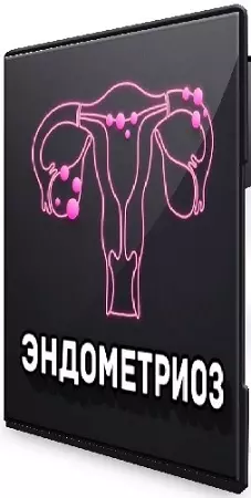 Виктория Самира - Эндометриоз (2026) Лекция